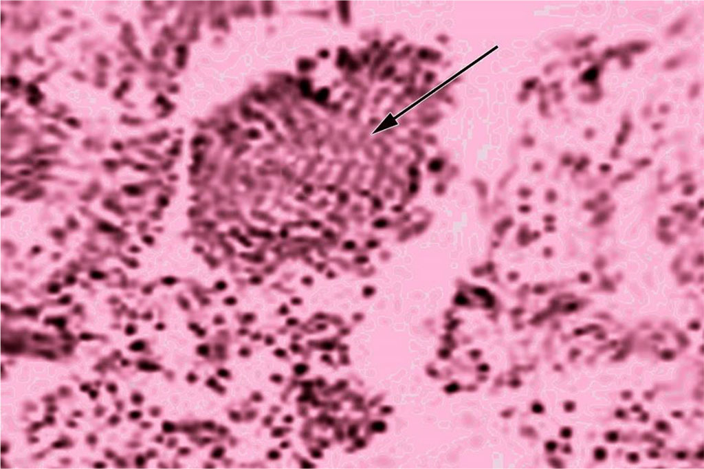 Fig. Lymphoid nodules in the intrahepatic bile duct, transverse section. Hematoxylin-eosin staining. Magnification 190x