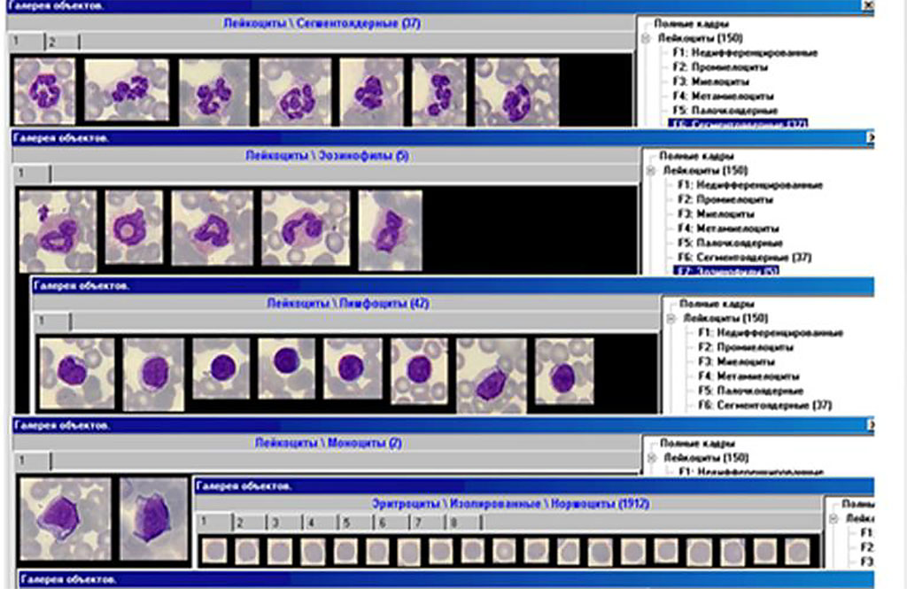 Figure 2. The indicators of leukocyte formula.