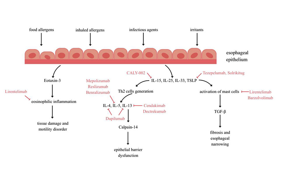 Figure 1 (Image by Author) illustrates the pathogenesis of eosinophilic esophagitis, with particular emphasis on the molecular targets of biologic therapies