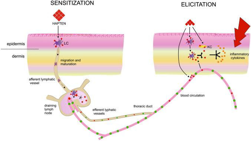 Figure 2. The exposure phase of allergic contact dermatitis /Kiecka A, 2023/.