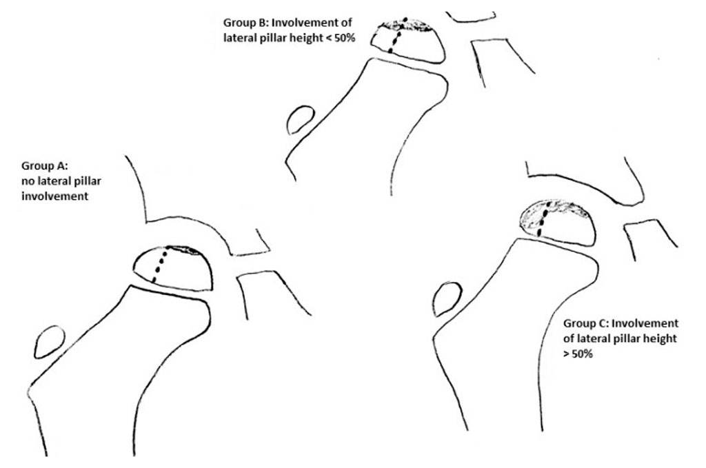 Fig. 2 Herring classification [29].